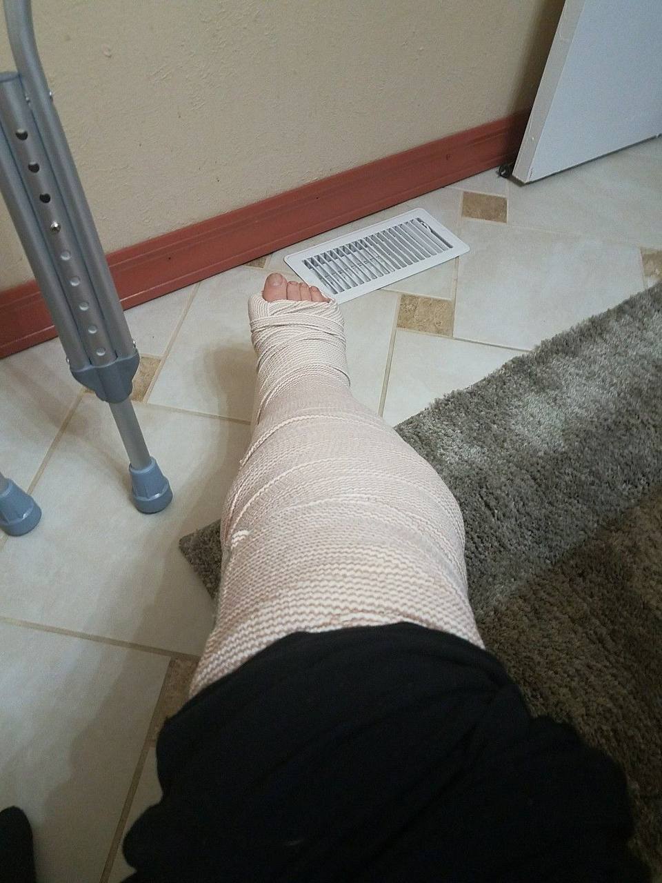 عکس فیک بیمارستان پا شکسته