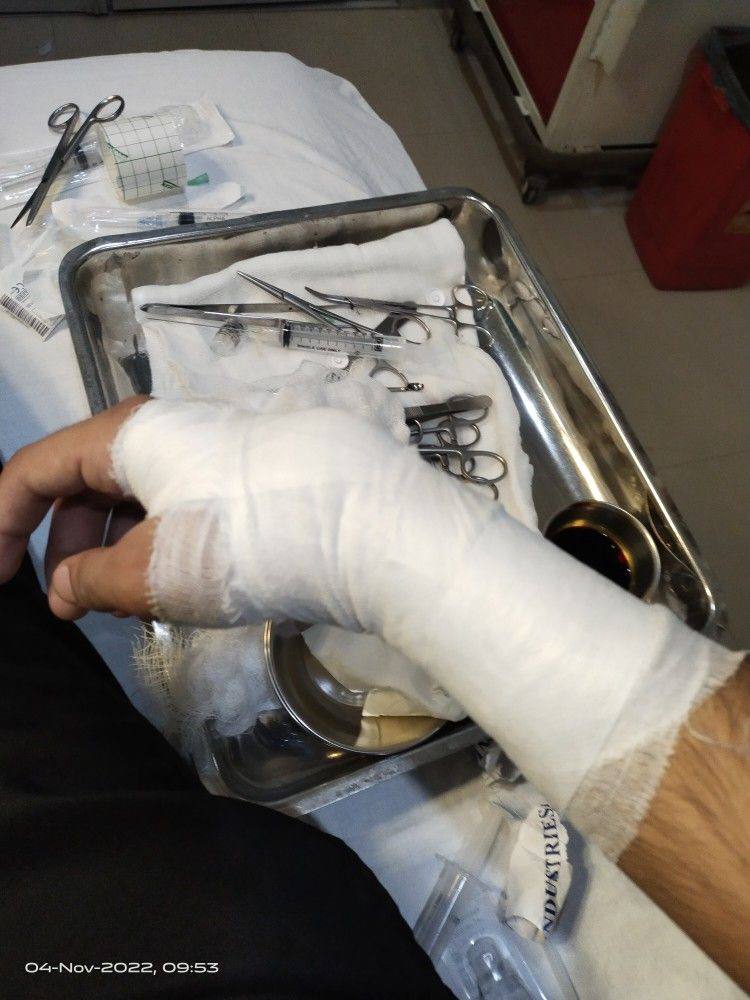 عکس فیک بیمارستان پا شکسته