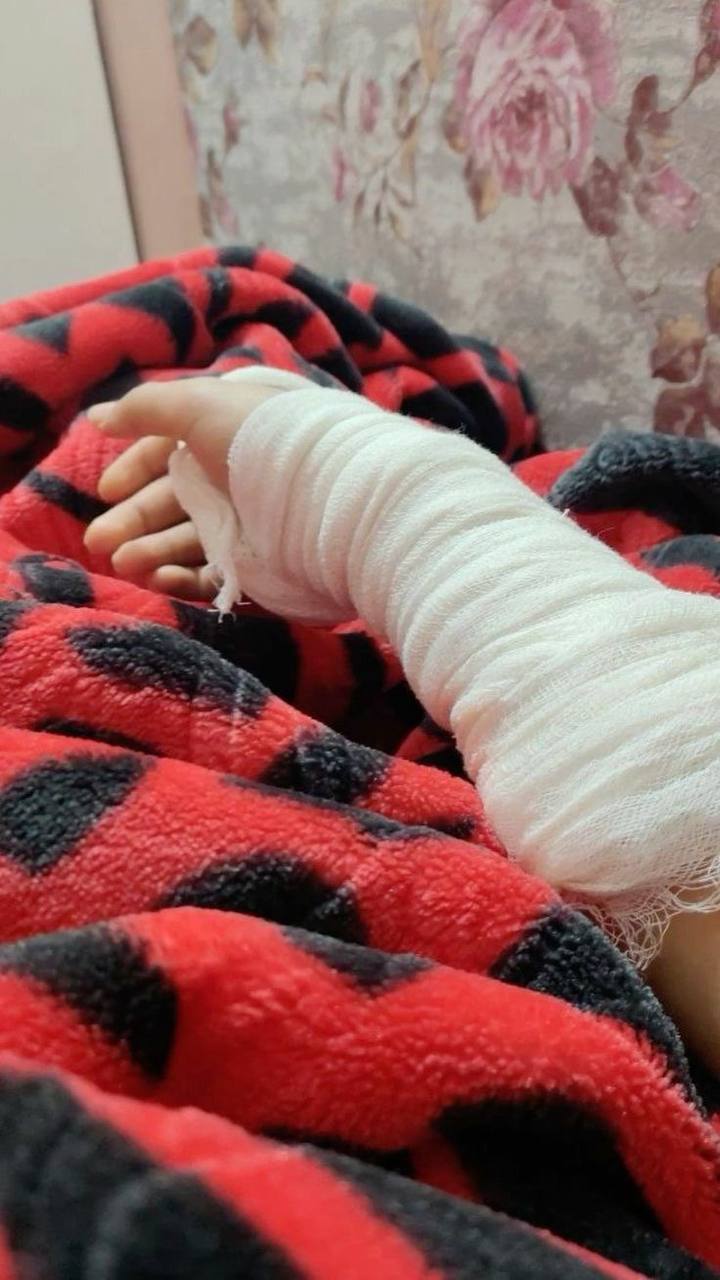 عکس فیک بیمارستان پا شکسته