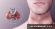 آیا کم کاری تیروئید باعث مرگ میشود؟ بررسی خطرات و علائم در زنان و مردان