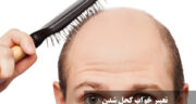 تعبیر خواب کچل شدن زن، مرد، مجرد، متاهل، وسط سر و جلوی سر از نظر امام صادق و حضرت یوسف