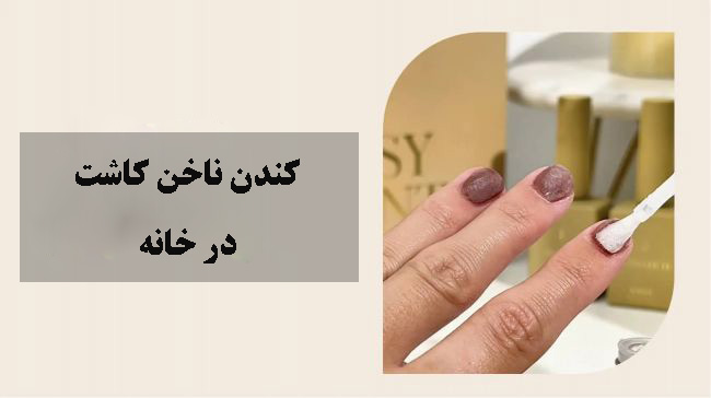 کندن ناخن کاشت