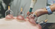 تقویم حجامت 1404 دکتر خیراندیش زمان‌ بندی دقیق با توصیه های دکتر خیراندیش