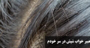تعبیر خواب شپش در سر خودم، دیگران برای دختر مجرد و متاهل از نظر امام صادق و حضرت یوسف