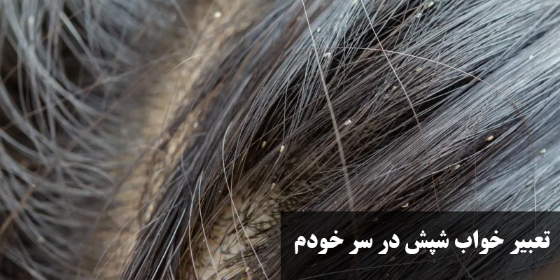 تعبیر خواب شپش در سر خودم
