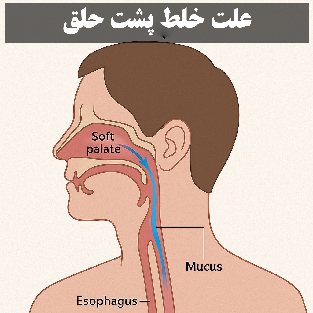 علت خلط پشت حلق