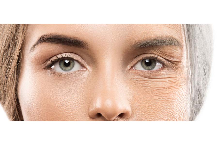 چگونه پیری پوست را به تاخیر بیندازیم؟