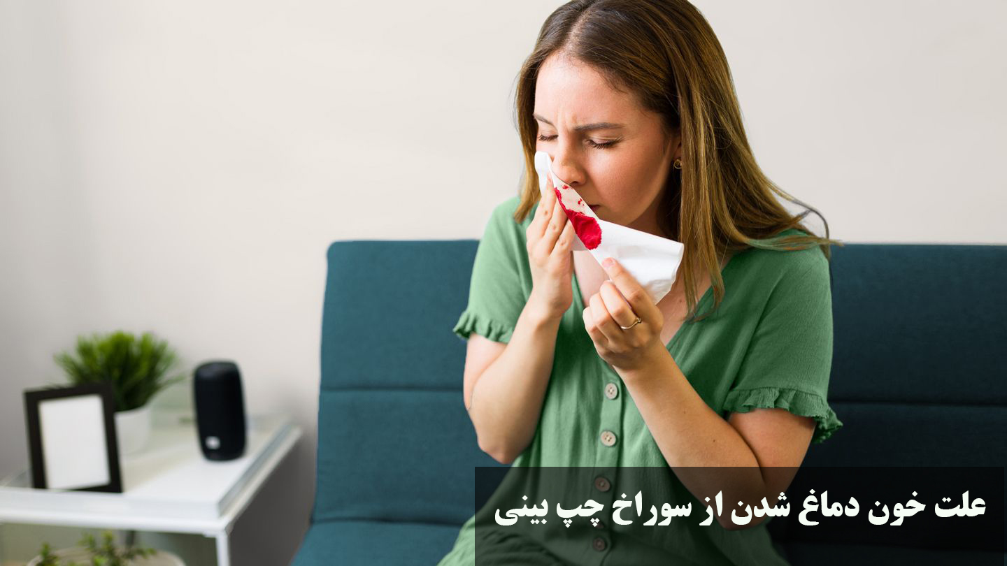 علت خون دماغ شدن از سوراخ چپ بینی 