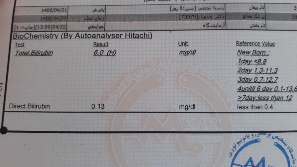 تفسیر آزمایش زردی نوزاد