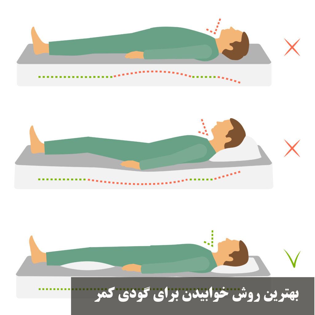بهترین روش خوابیدن برای گودی کم