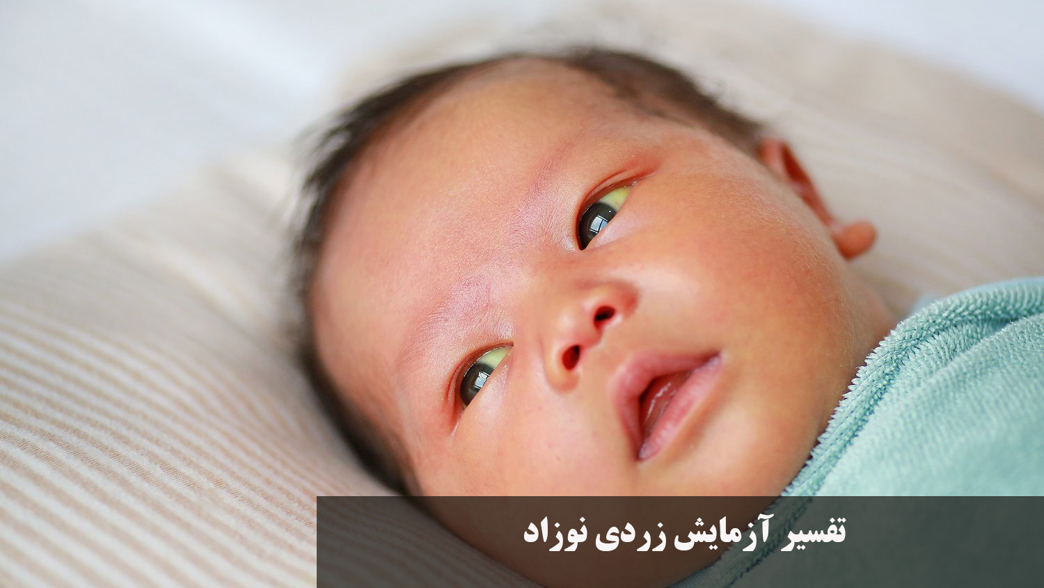 تفسیر آزمایش زردی نوزاد (bilirubin direct) آزمایش زردی نوزاد باید چند باشد + جدول درجه بندی زردی نوزاد