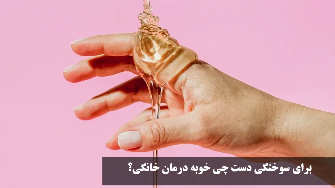 برای سوختگی دست چی خوبه درمان خانگی؟(درمان سریع سوختگی) بهترین پماد سوختگی خانگی