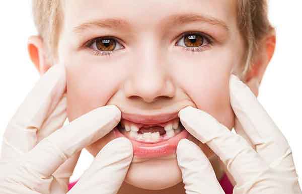 تعبیر خواب افتادن دندان جلو