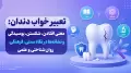 تعبیر خواب دندان: معنی افتادن، شکستن، پوسیدگی و نشانه‌ها در نگاه سنتی، فرهنگی، روان‌شناختی و علمی