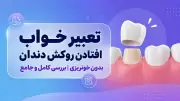 تعبیر خواب افتادن روکش دندان بدون خونریزی | بررسی کامل و جامع