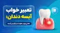 تعبیر خواب آبسه دندان: معنی ورم، عفونت و ترکیدن آبسه