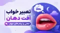 تعبیر خواب آفت دهان | معنی و پیام های مهم