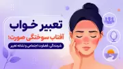 تعبیر خواب آفتاب سوختگی صورت؛ شرمندگی، قضاوت اجتماعی و نشانه تغییر